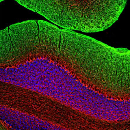 Polyclonal Antibody to Neurofilament NF-M