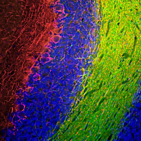 Polyclonal Antibody to Neurofilament NF-M