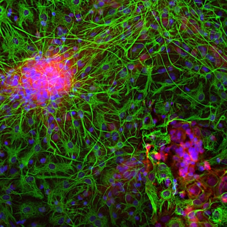 Polyclonal Antibody to Neuron Specific Enolase