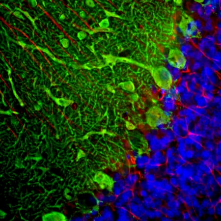 Polyclonal Antibody to Parvalbumin