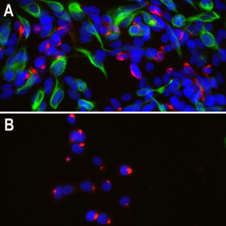 Monoclonal Antibody to Peripherin  (Clone: 8G2)