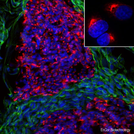 Monoclonal Antibody to Peripherin  (Clone: 7C5)