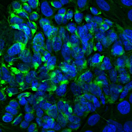 Polyclonal Antibody to Peripherin