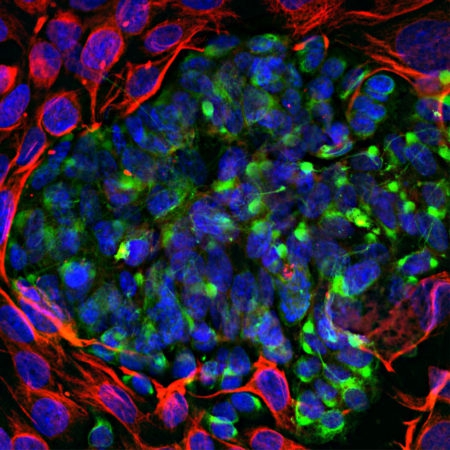 Polyclonal Antibody to Peripherin