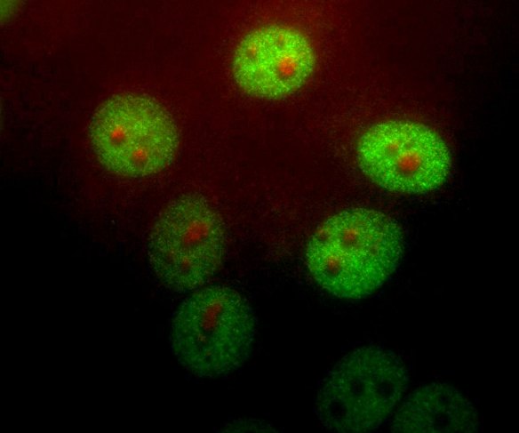 Polyclonal Antibody to Pin1(Discontinued)