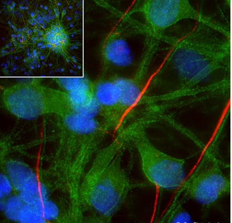 Polyclonal Antibody to Alpha-II spectrin (Discontinued)