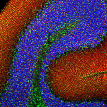 Monoclonal Antibody to Alpha-synuclein  (Clone: 2A7)