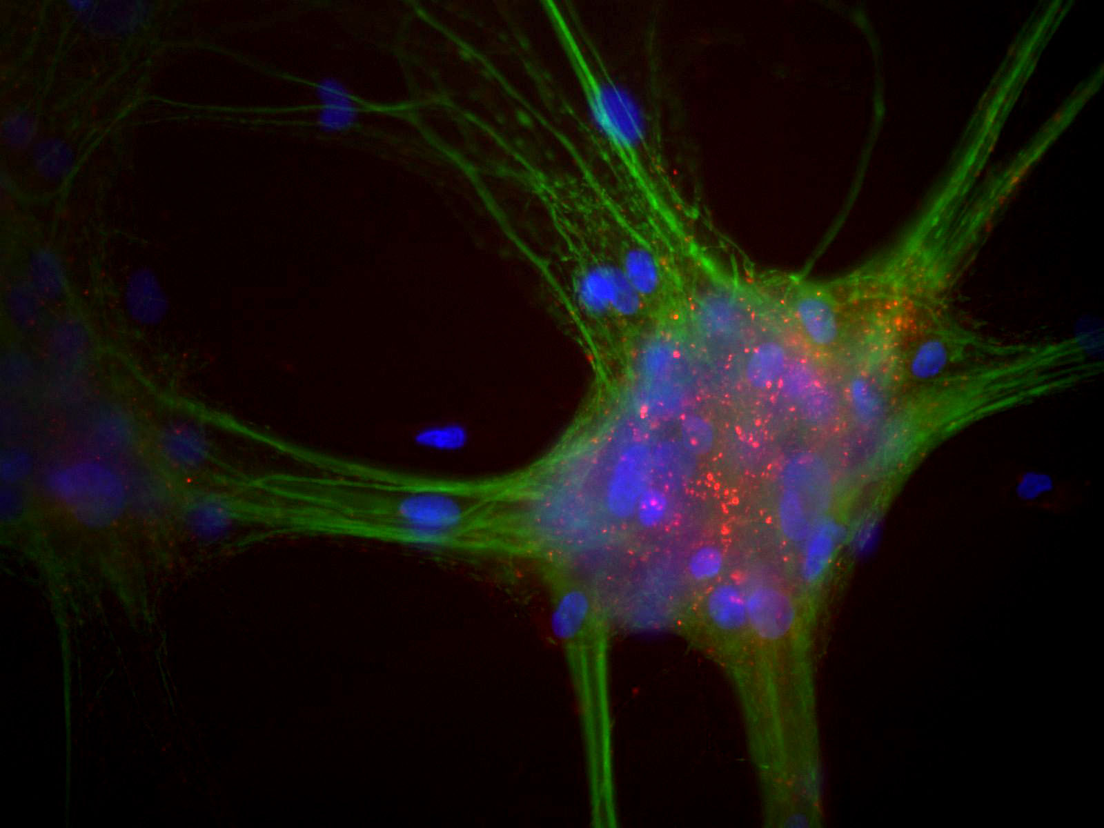 Monoclonal Antibody to Alpha-synuclein  (Clone: 3H9)(Discontinued)