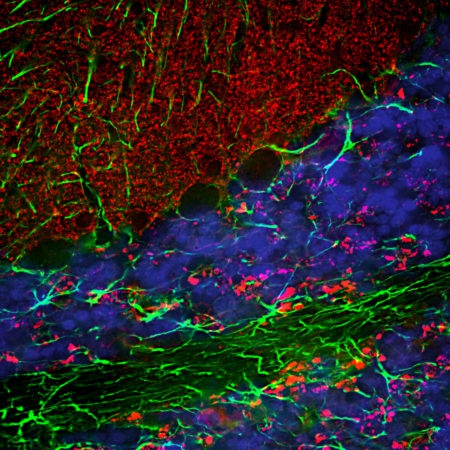 Polyclonal Antibody to Alpha-synuclein