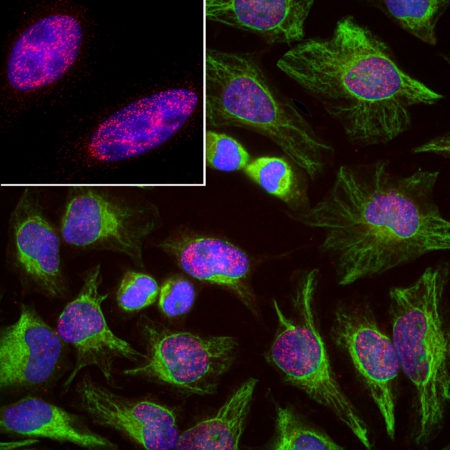 Monoclonal Antibody to Splicing factor SF3B4(Clone: 3A1)