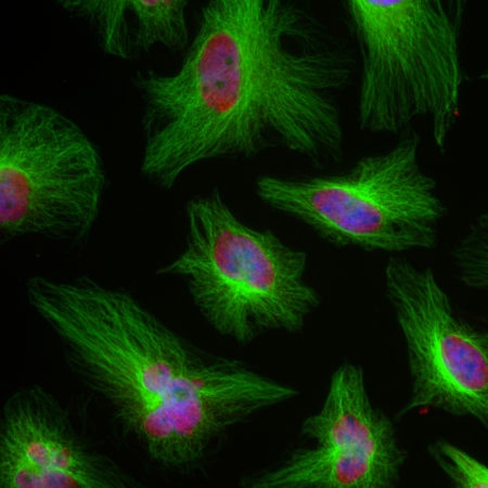 Monoclonal Antibody to Beta Tubulin(Clone: 1B12)