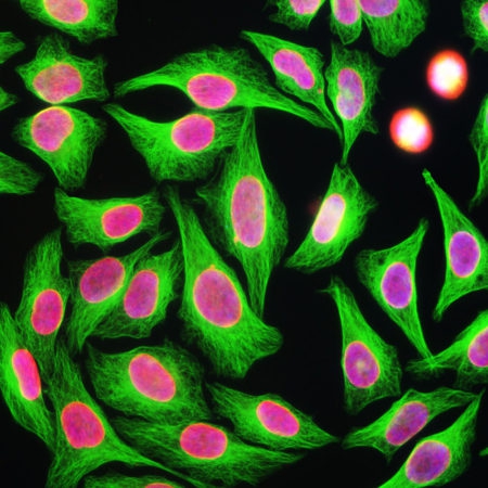 Monoclonal Antibody to Beta Tubulin(Clone: 4E4)