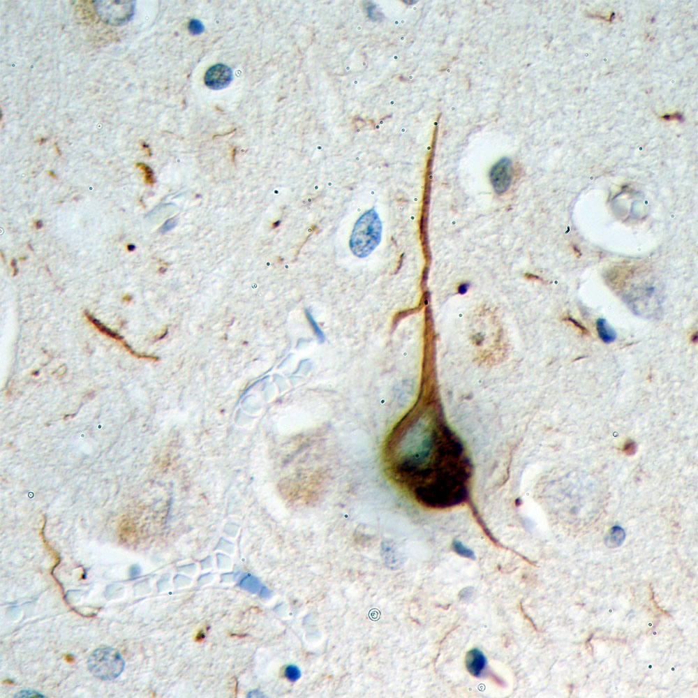 Monoclonal Antibody to Ubiquitin  (Clone: Ubi-1)