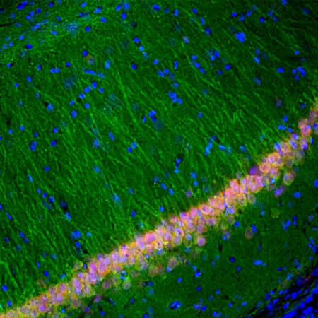 Monoclonal Antibody to Ubiquitin C-terminal hydrolase 1 , UCHL1(Clone: BH7)