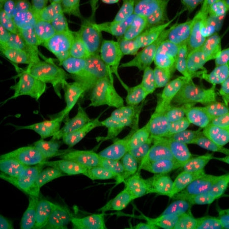 Polyclonal Antibody to Ubiquitin C-terminal hydrolase 1, UCHL1