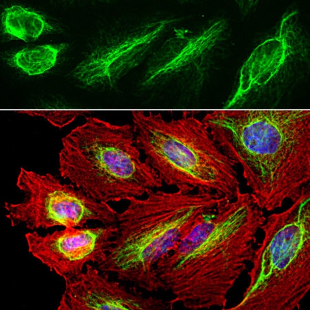 Polyclonal Antibody to Vimentin