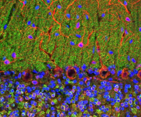 Monoclonal Antibody to Visinin-like protein 1  (Clone: 3A9)