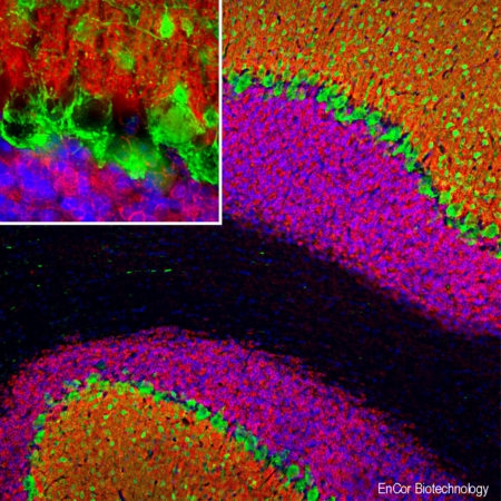 Polyclonal Antibody to Visinin-like protein 1