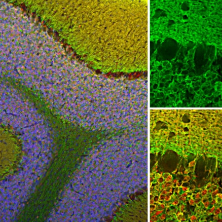 Polyclonal Antibody to Visinin-like protein 1