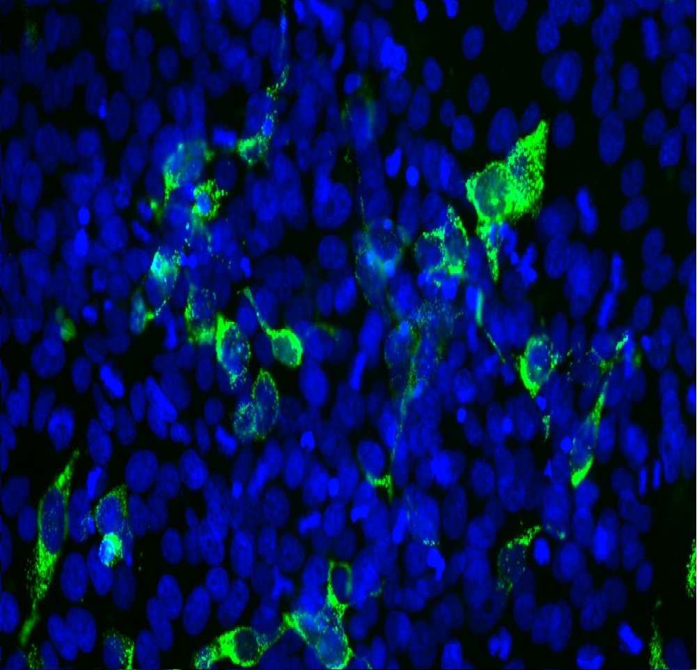 Mouse monoclonal antibody to SARS-CoV2 (ACE2 binding domain) (Clone:2G1)