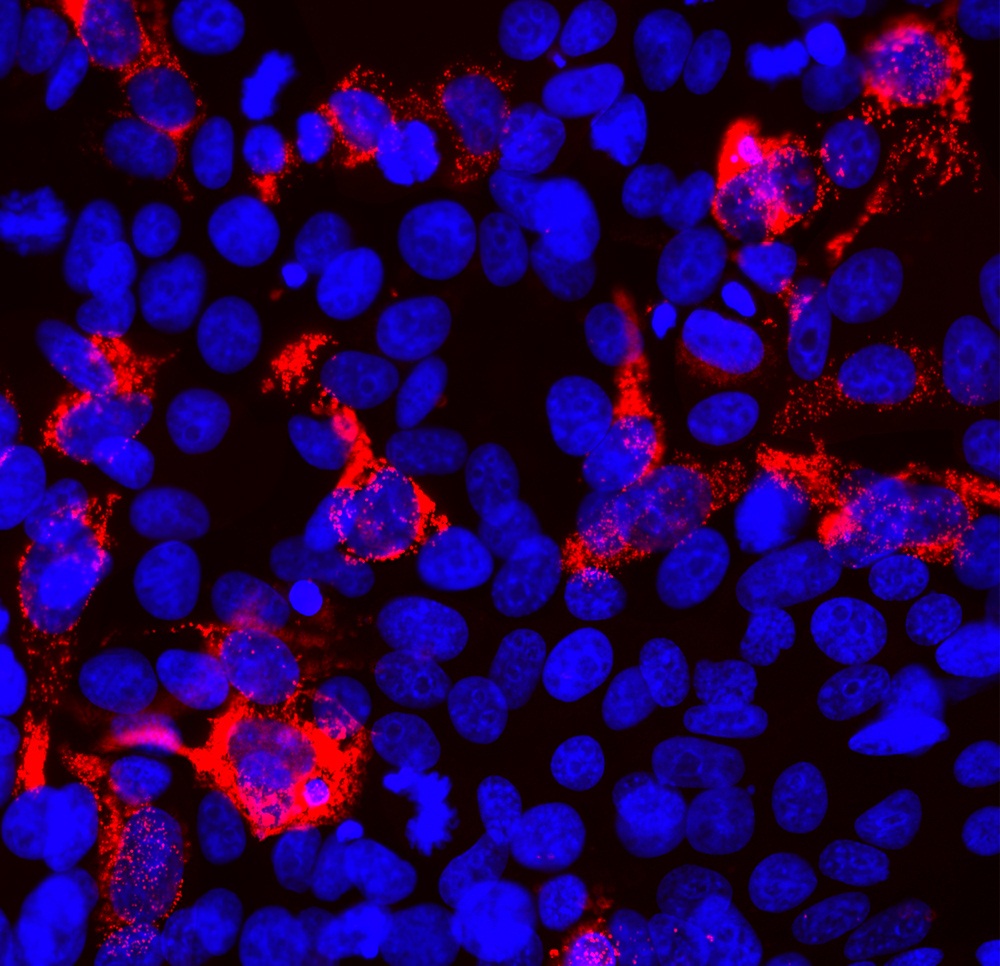 Mouse monoclonal antibody to SARS-CoV2 (ACE2 binding domain) (Clone:5G8)