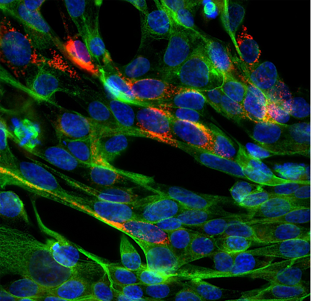 Rabbit polyclonal antibody to SARS-CoV2 S-protein (ACE2 binding domain)