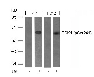 Polyclonal Antibody to PDK1 (Phospho-Ser241)