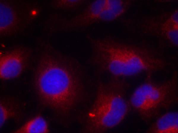 Polyclonal Antibody to PTEN(Phospho-Ser380)