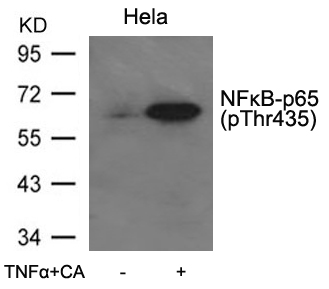 Polyclonal Antibody to NFkB-p65(Phospho-Thr435)