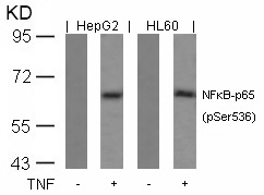 Polyclonal Antibody to NFkB-p65 (Phospho-Ser536)