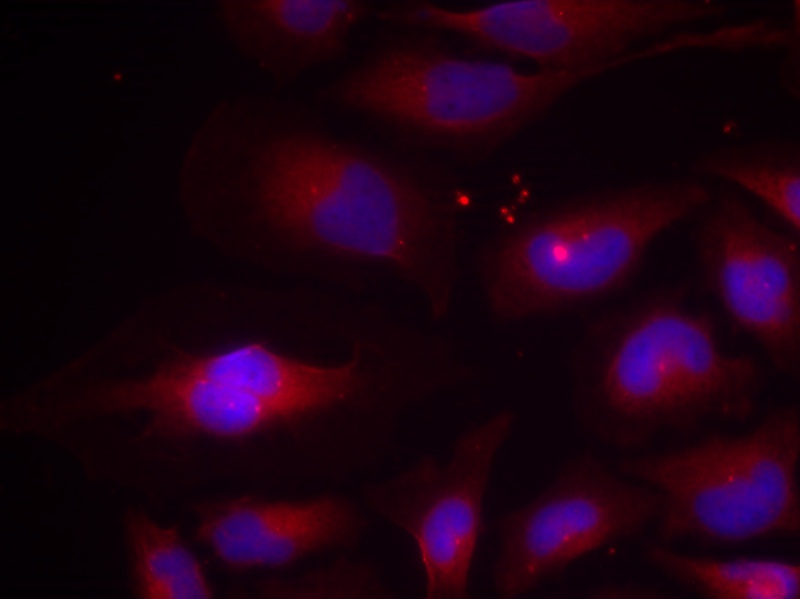 Polyclonal Antibody to NFkB-p100/p52(Phospho-Ser870)