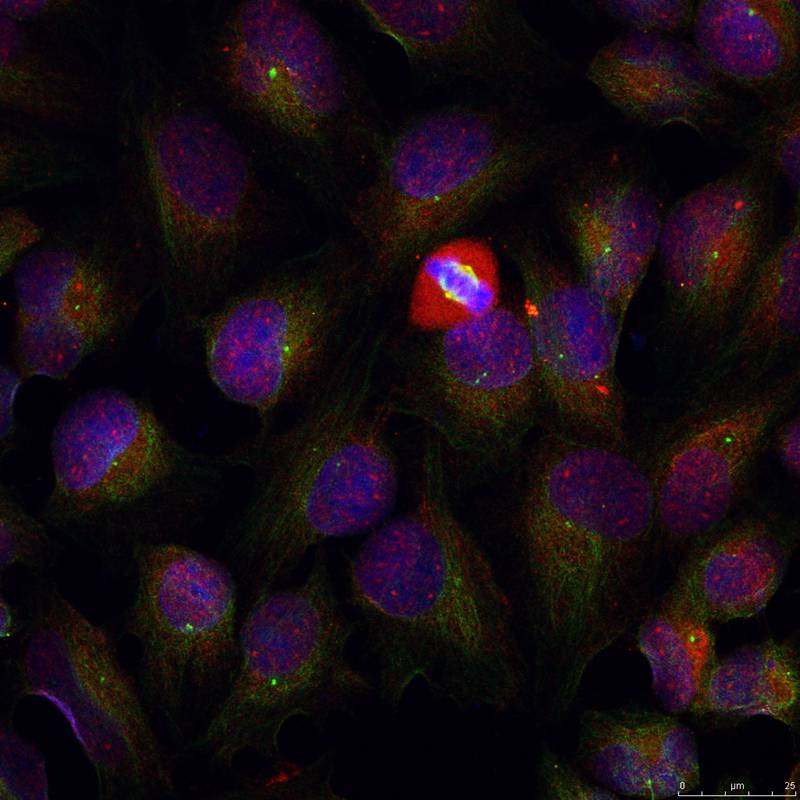 Polyclonal Antibody to NFkB-p105/p50(Phospho-Ser337)