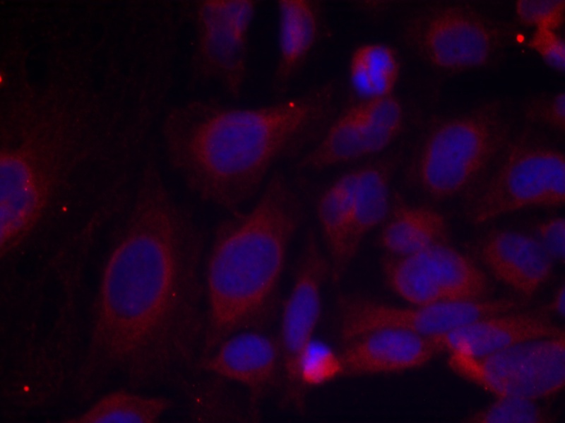 Polyclonal Antibody to NFkB-p105/p50(Phospho-Ser893)