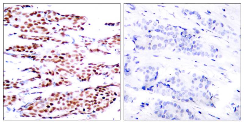 Polyclonal Antibody to JunB (Phospho-Ser79)