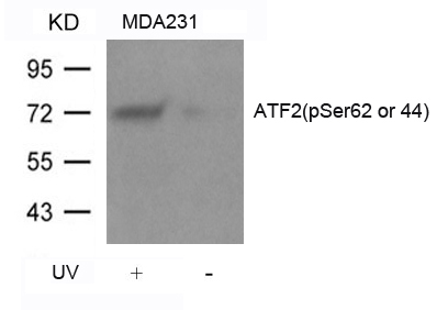 Polyclonal Antibody to ATF2 (Phospho-Ser62 or 44)