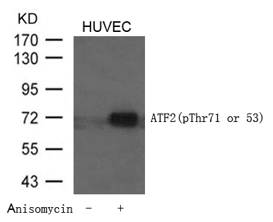 Polyclonal Antibody to ATF2 (Phospho-Thr71 or 53)