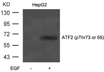 Polyclonal Antibody to ATF2 (Phospho-Thr73 or 55)