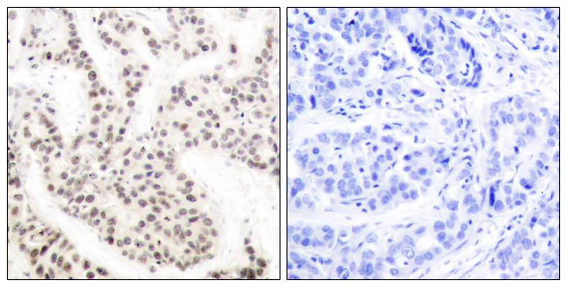 Polyclonal Antibody to Elk1(Phospho-Thr417)