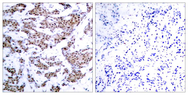 Polyclonal Antibody to MEF2A (Phospho-Thr312)