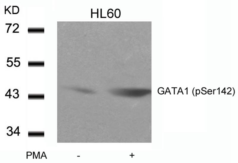 Polyclonal Antibody to GATA1 (Phospho-Ser142)