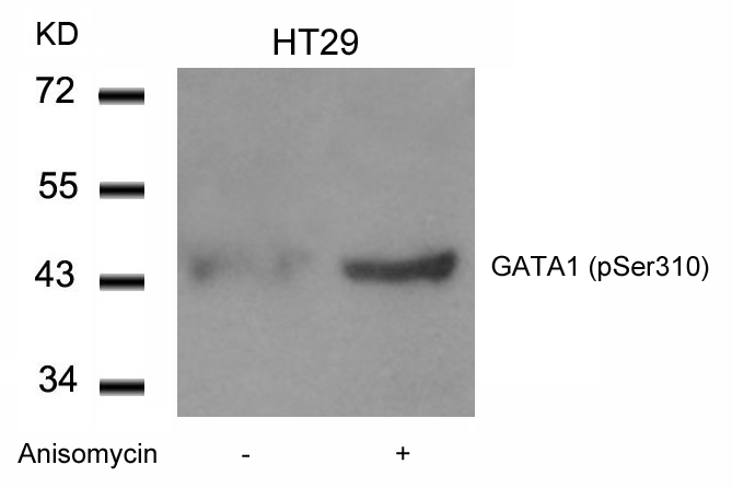 Polyclonal Antibody to GATA1 (Phospho-Ser310)