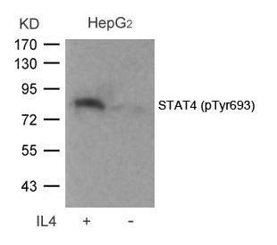 Polyclonal Antibody to STAT4 (Phospho-Tyr693)