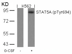 Polyclonal Antibody to STAT5A (Phospho-Tyr694)