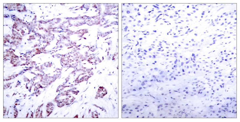 Polyclonal Antibody to STAT6 (Phospho-Thr645)