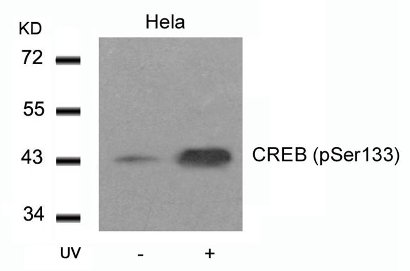 Polyclonal Antibody to CREB (Phospho-Ser133)