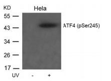 Polyclonal Antibody to ATF4 (Phospho-Ser245)