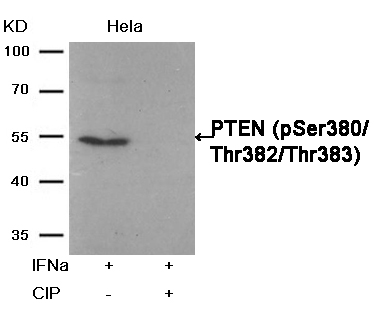 Polyclonal Antibody to PTEN (Phospho-Ser380/Thr382/Thr383)