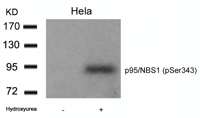 Polyclonal Antibody to p95/NBS1 (Phospho-Ser343)