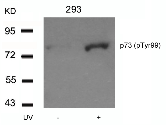 Polyclonal Antibody to p73 (Phospho-Tyr99)