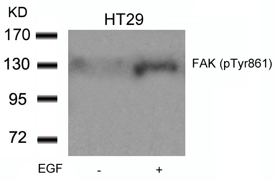 Polyclonal Antibody to FAK (Phospho-Tyr861)